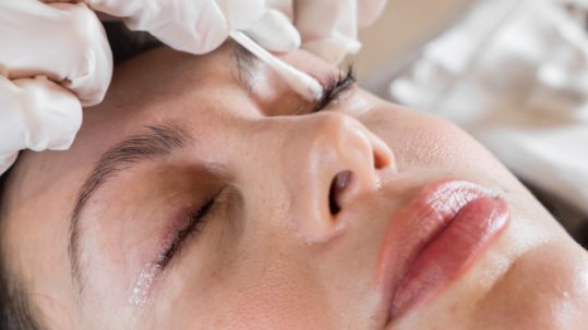 marra duge trepavice